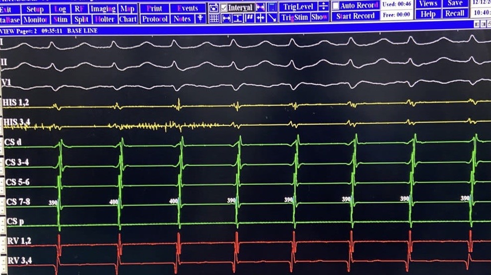 Best-Cardiologist-in-Chennai