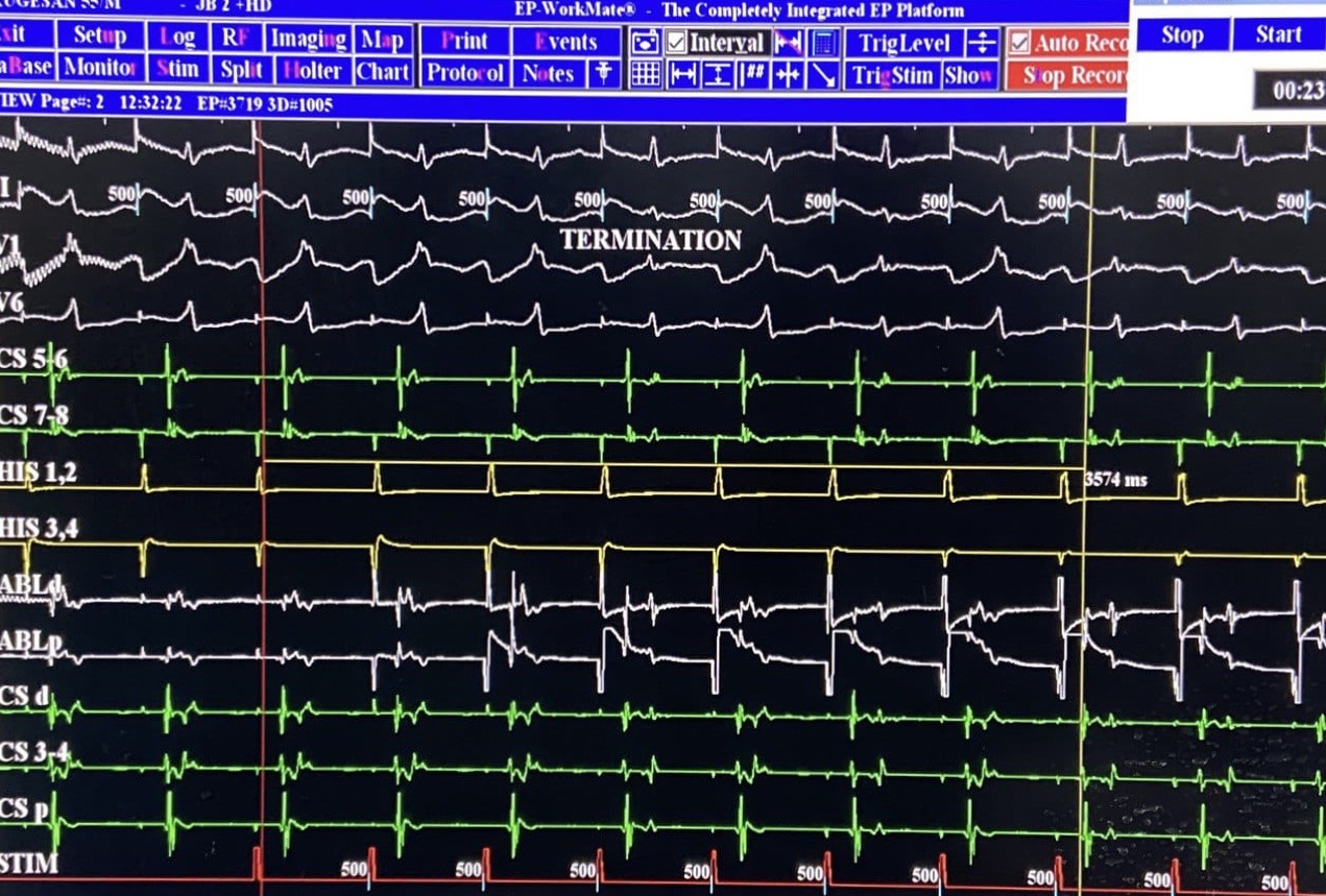 Best-Cardiologist-in-Chennai