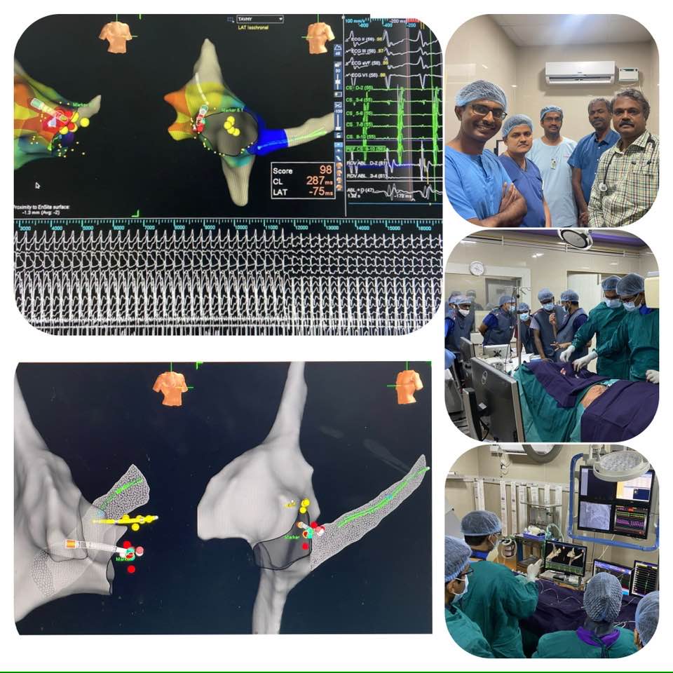 Training at Command Hospital with Dr. Deep Chandh Raja, the Best Cardiologist in Chennai, India
